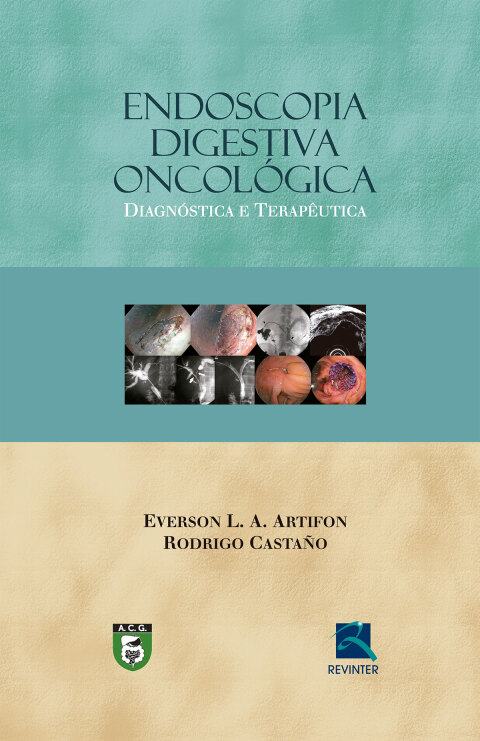 Cover image for book Endoscopia Digestiva Oncológica