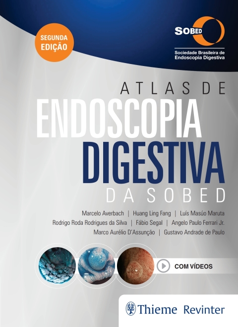 Cover image for book Atlas de Endoscopia Digestiva da SOBED
