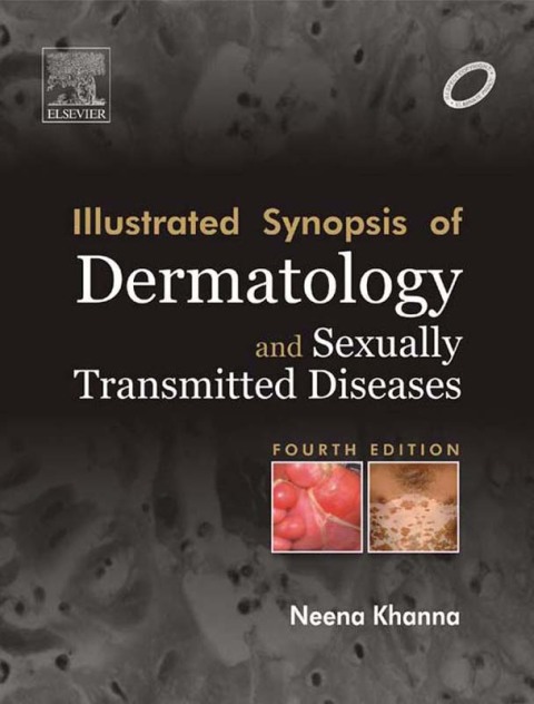 Illustrated Synopsis of Dermatology \u0026 Sexually Transmitted Diseases 