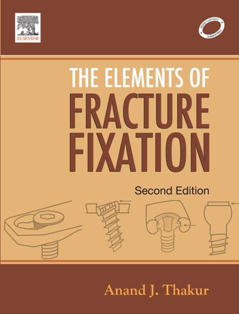 Cover image for book Elements of Fracture Fixation