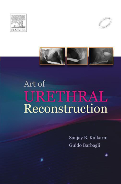 Cover image for book Art of Urethral Reconstruction