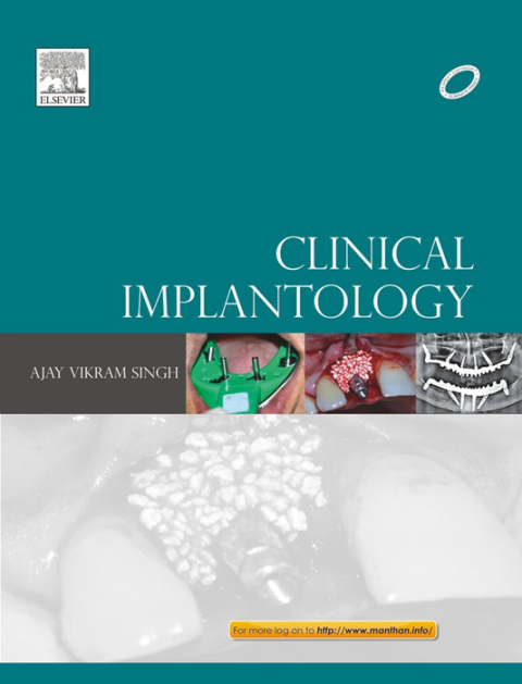 Clinical Implantology 