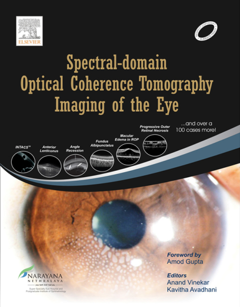 Cover image for book Spectral-domain Optical Coherence Tomography Imaging of the Eye