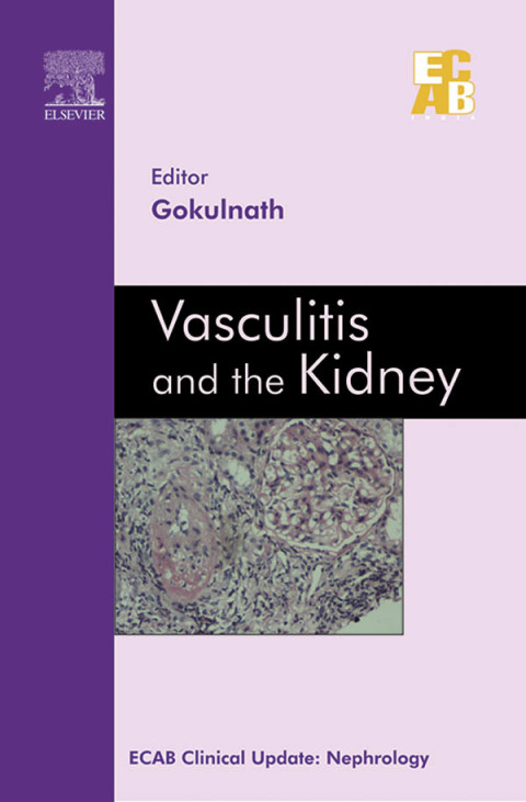 Cover image for book Vasculitis and the Kidney - ECAB