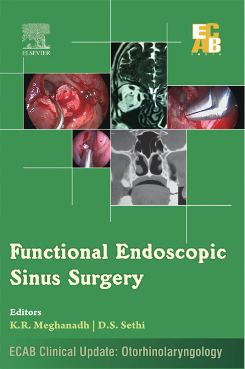 Cover image for book Functional Endoscopic Sinus Surgery - ECAB