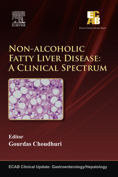 Cover image for book ECAB Non-alcoholic Fatty Liver Disease
