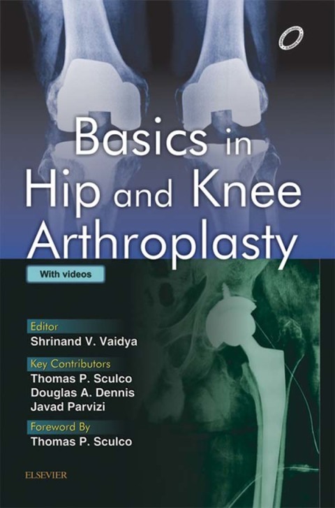 Cover image for book Basics in Hip and Knee Arthroplasty