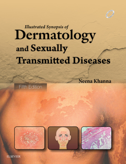 Illustrated Synopsis of Dermatology \u0026 Sexually Transmitted Diseases 