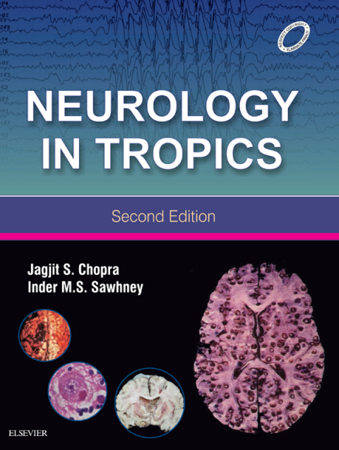 Cover image for book Neurology in Tropics