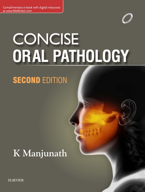 Cover image for book Concise Oral Pathology