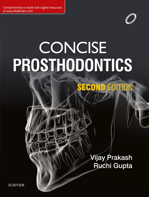 Cover image for book Concise Prosthodontics: Prep Manual for Undergraduates