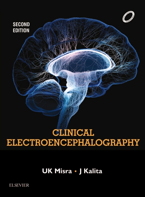 Cover image for book Clinical Electroencephalography