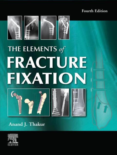 Cover image for book The Elements of Fracture Fixation