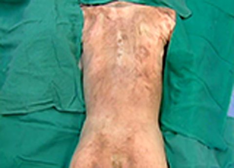 Cover image for book Back and Vertebral Column - Vertebral Column and Back Musculature