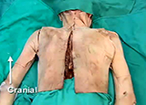 Cover image for book Upper Limb - Posterior Shoulder