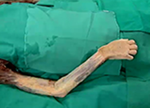 Cover image for book Upper Limb  - Flexor and Extensor Compartment of the Arm and Shoulder Joint