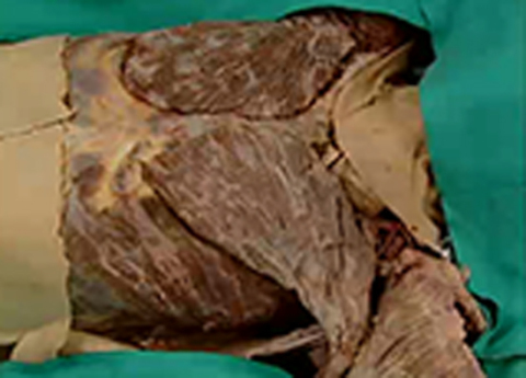 Cover image for book Thorax - Anterior Body Wall, Mediastinum and Heart