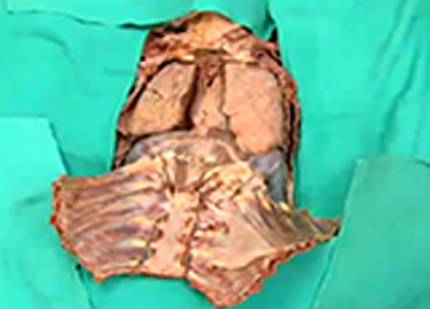 Cover image for book Thorax - Lungs and Pleural Cavity