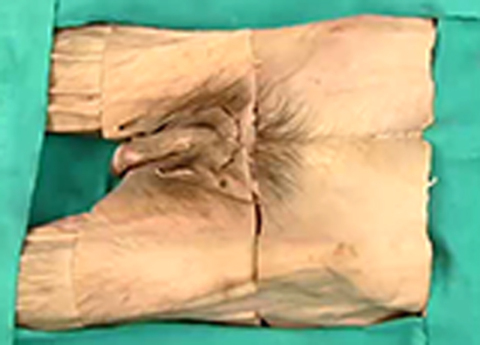 Cover image for book Pelvis - Male External Genitalia and Perineum