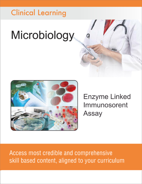 Cover image for book Enzyme Linked Immunosorbent Assay