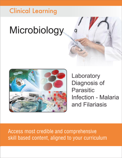 Cover image for book Laboratory Diagnosis of Parasitic Infection - Malaria and Filariasis