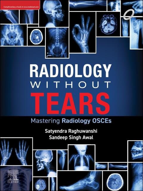 Radiology Without Tears 
