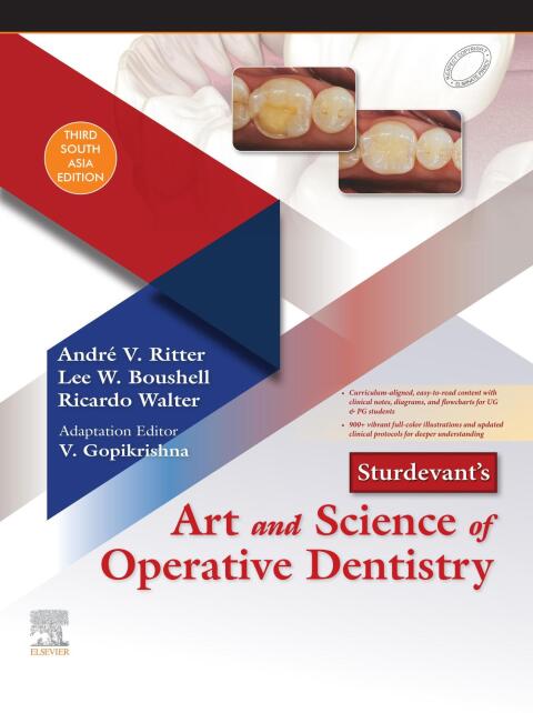 Sturdevantâs Art and Science of Operative Dentistry - E-Book 