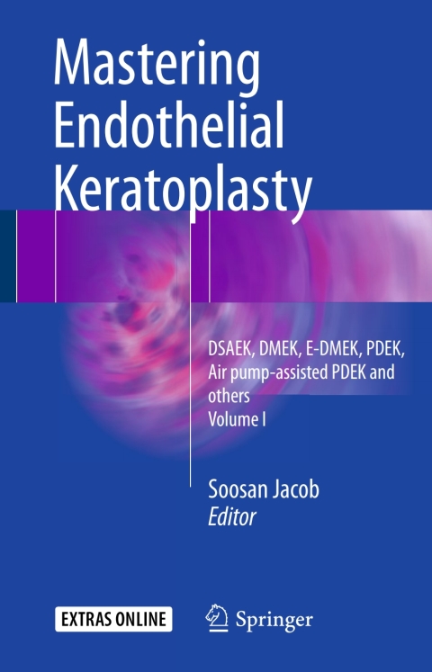 Cover image for book Mastering Endothelial Keratoplasty