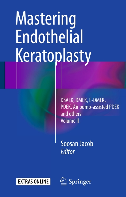 Cover image for book Mastering Endothelial Keratoplasty