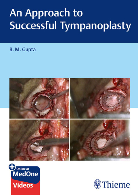 Cover image for book An Approach to Successful Tympanoplasty