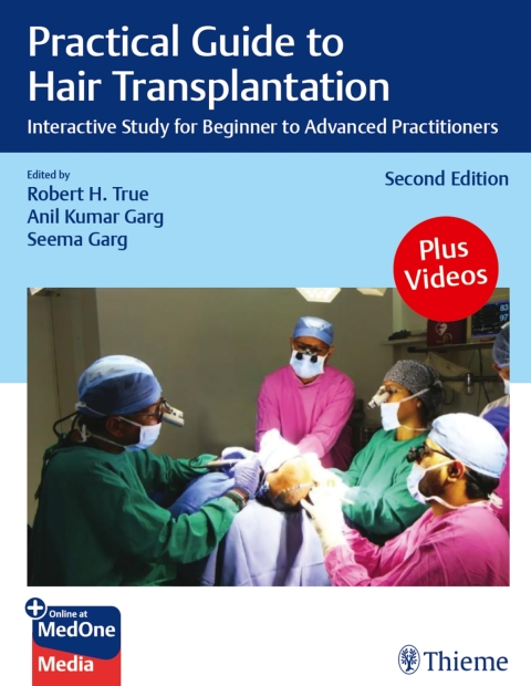 Cover image for book Practical Guide to Hair Transplantation
