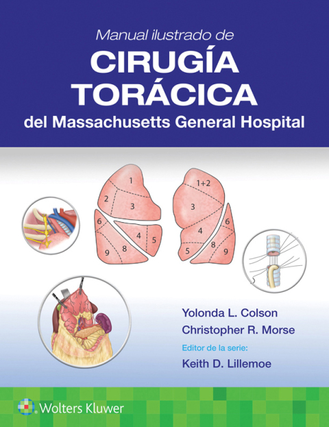 Cover image for book Manual ilustrado de Cirugía torácica del Massachusetts General Hospital