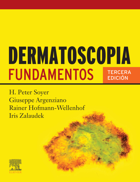 Dermatoscopia 