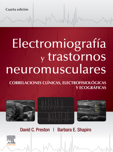 Cover image for book Electromiografía y trastornos neuromusculares
