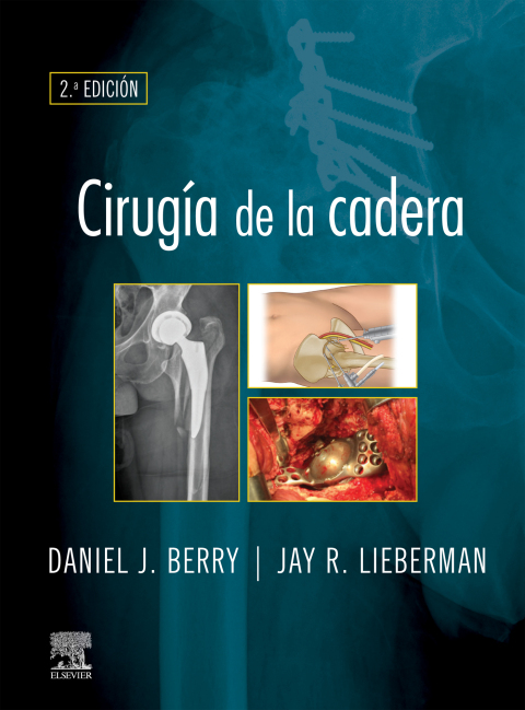 Cover image for book Cirugía de la cadera