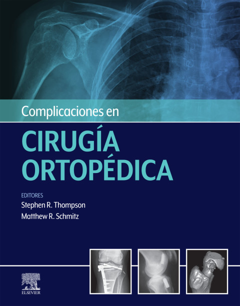 Cover image for book Complicaciones en cirugía ortopédica