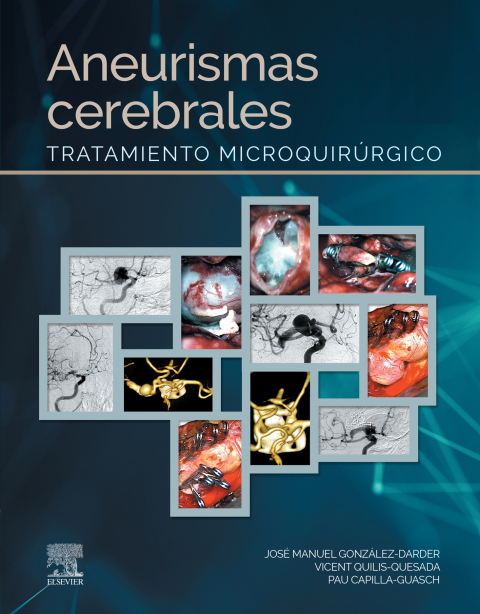Cover image for book Aneurismas cerebrales