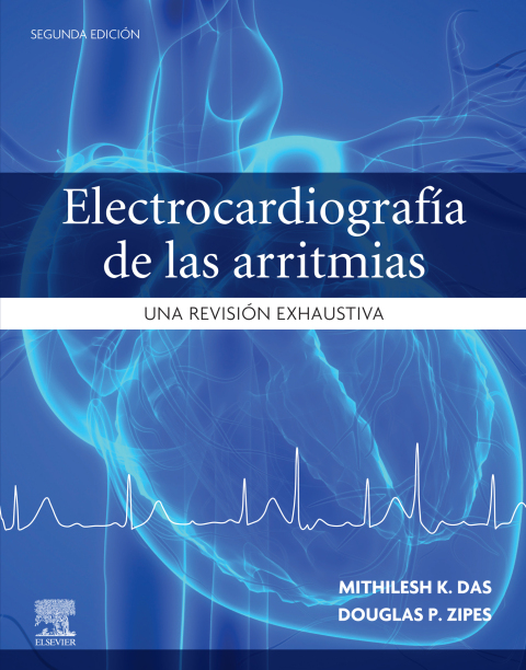 ElectrocardiografÃ­a de las arritmias 