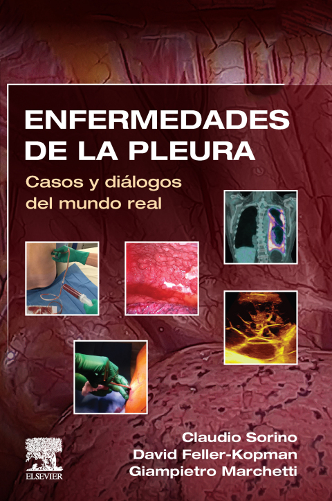 Cover image for book Enfermedades de la pleura