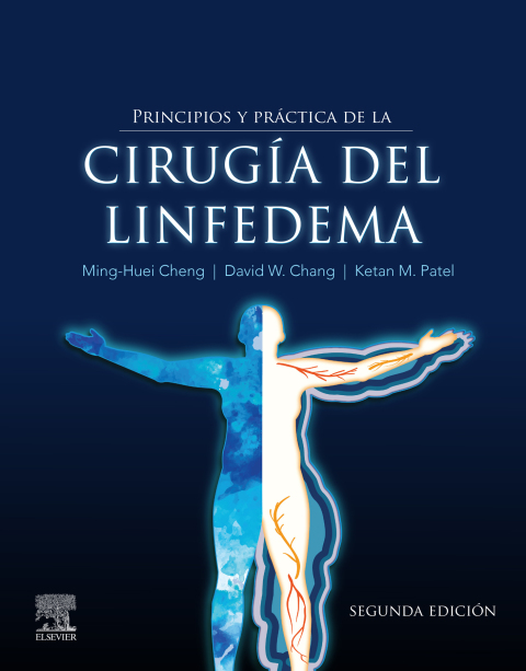 Principios y prÃ¡ctica de la cirugÃ­a del linfedema 