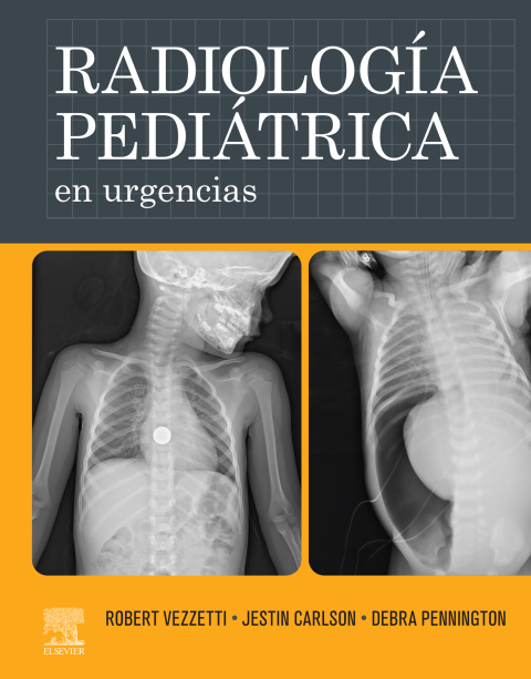 Cover image for book Radiología pediátrica en urgencias