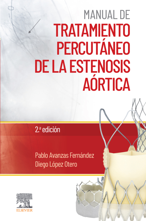 Cover image for book Manual de tratamiento percutáneo de la estenosis aórtica