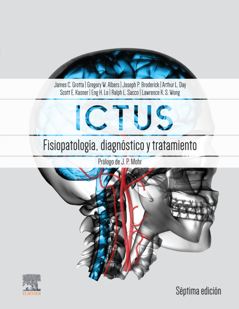 Cover image for book Ictus: Fisiopatología, diagnóstico y abordaje