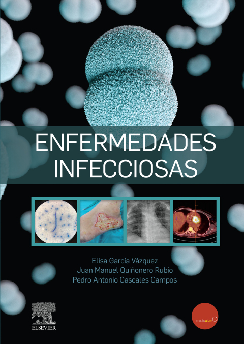 Cover image for book Enfermedades infecciosas