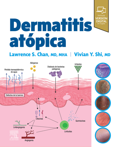 Cover image for book Dermatitis atópica