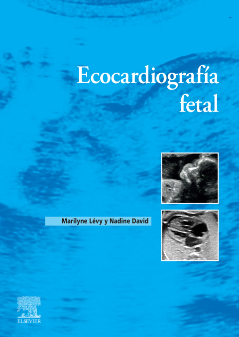 Cover image for book Ecocardiografía fetal