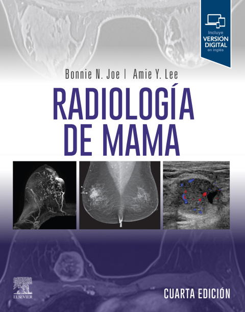 Cover image for book Radiología de mama