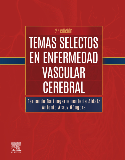 Cover image for book Temas selectos en enfermedad vascular cerebral