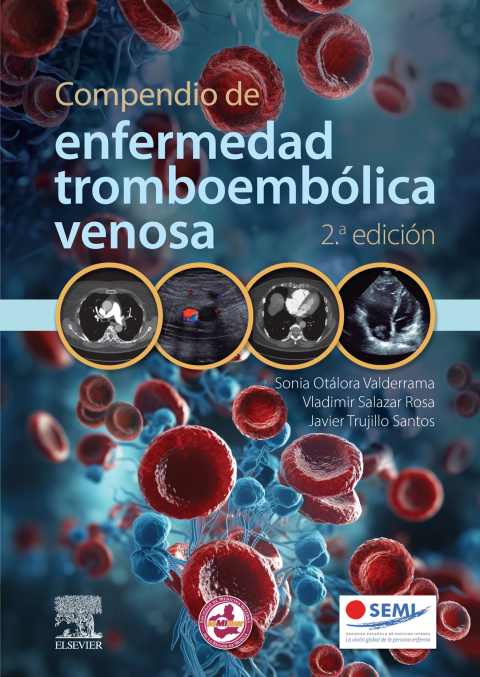 Cover image for book Compendio de enfermedad tromboembólica venosa
