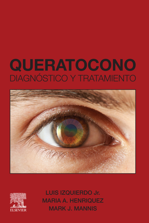 Cover image for book Queratocono